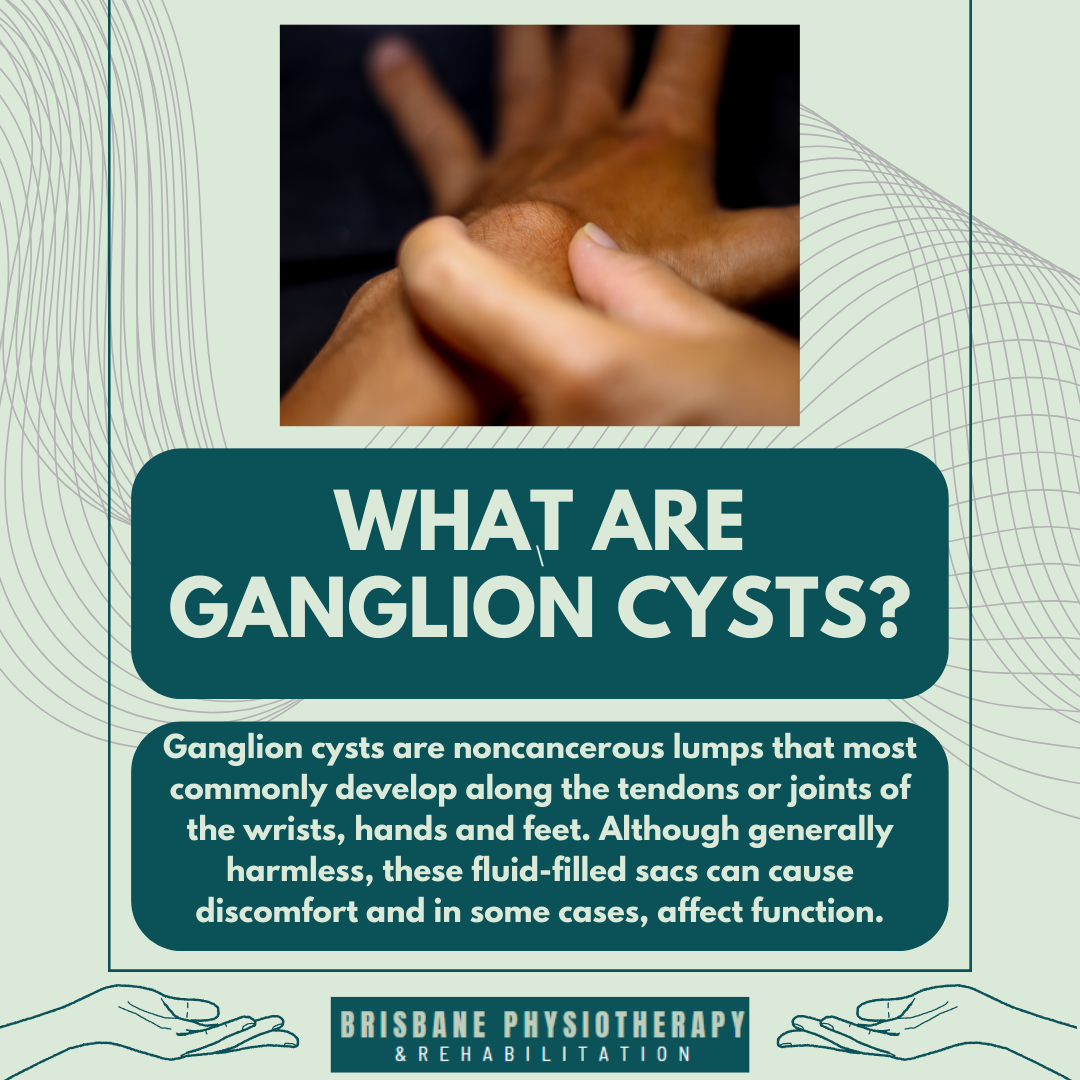 What Is Are Ganglion Cysts Brisbane Physiotherapy Podiatry