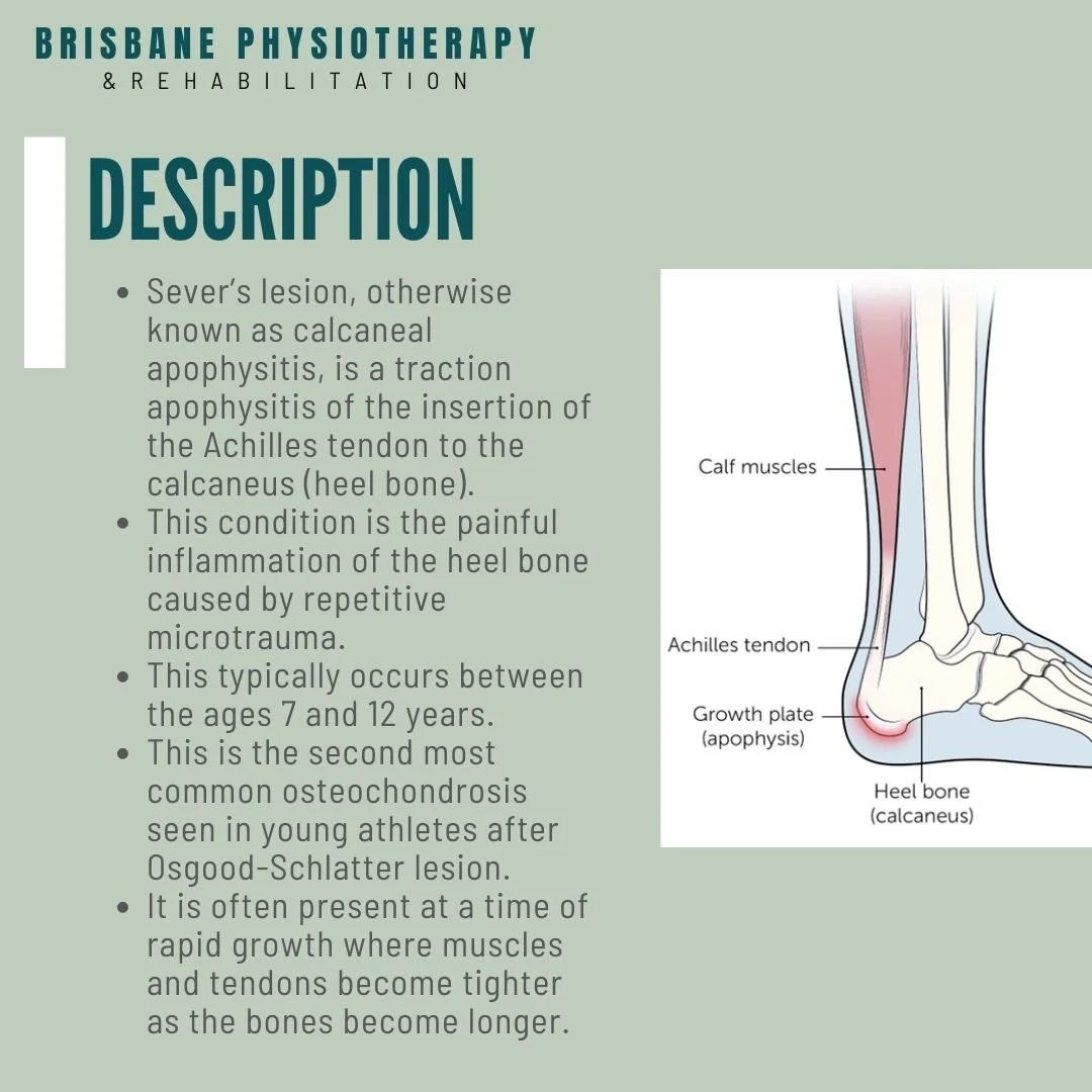 Sever S Disease Symptoms Sever S Disease Foot ZILCQG Sever S Disease Symptoms Sever S Disease Foot ZILCQG