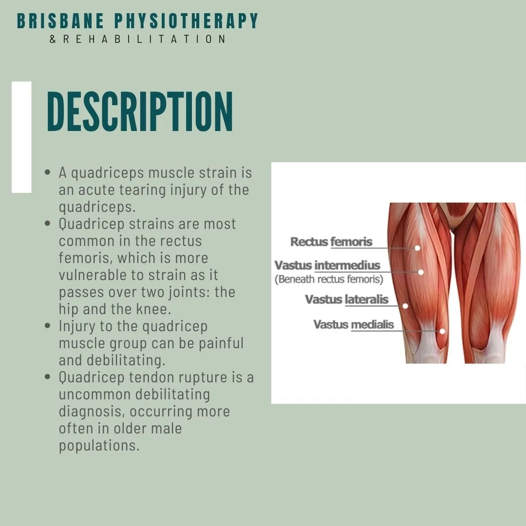 What is a Quadricep Strain? Brisbane Physiotherapy