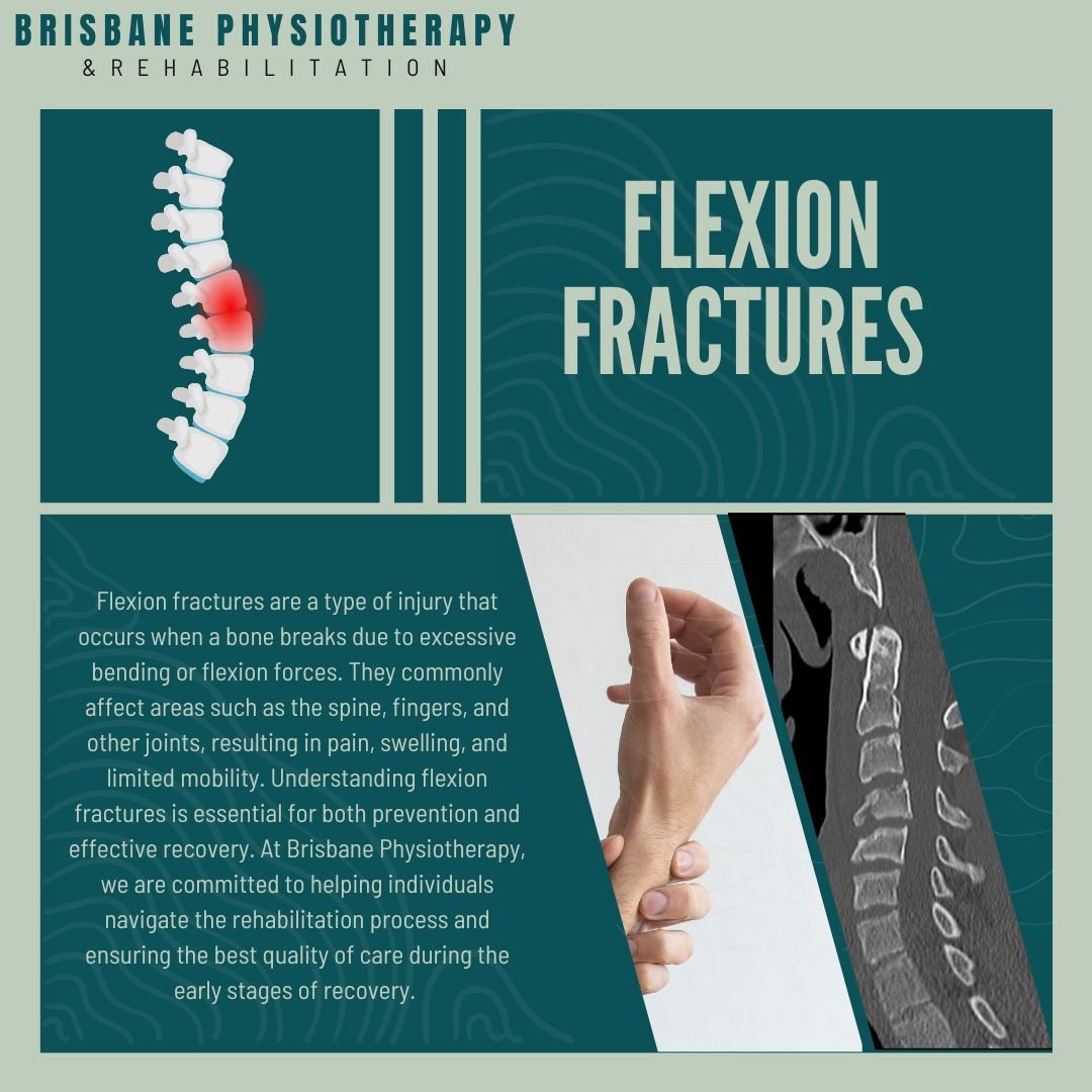 Flexion fractures - Brisbane Physiotherapy & Podiatry