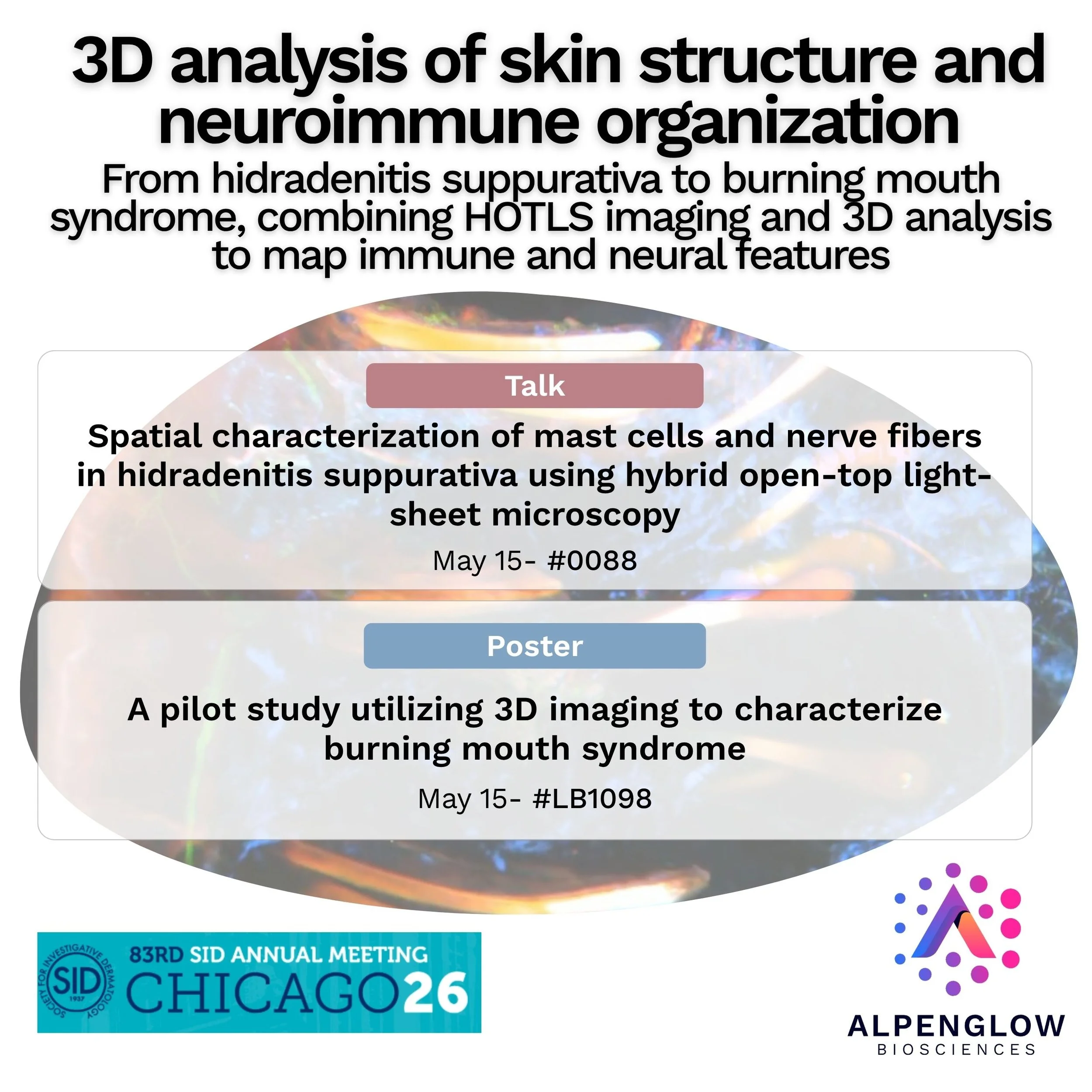 Poster and Talk Session at SID 2026