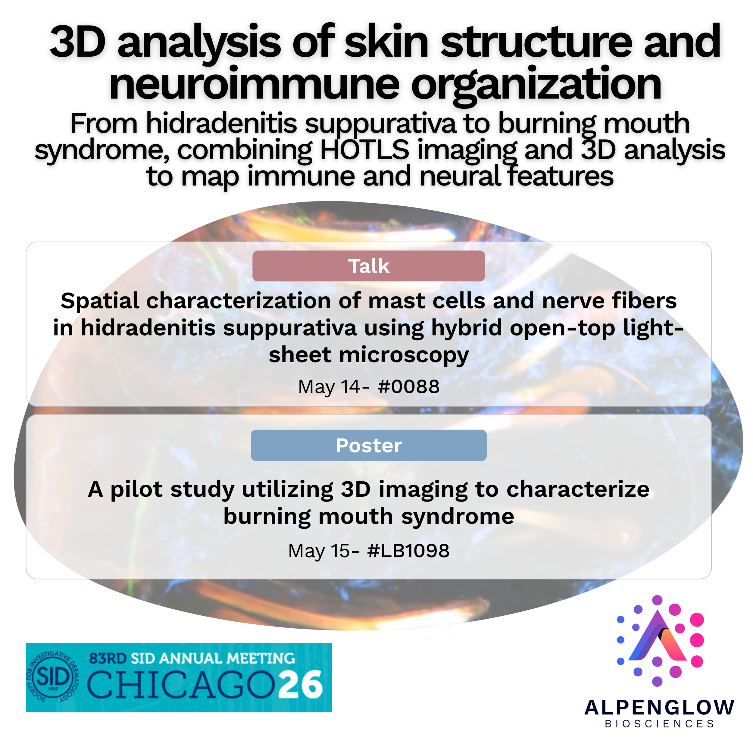 Poster and Talk Session at SID 2026
