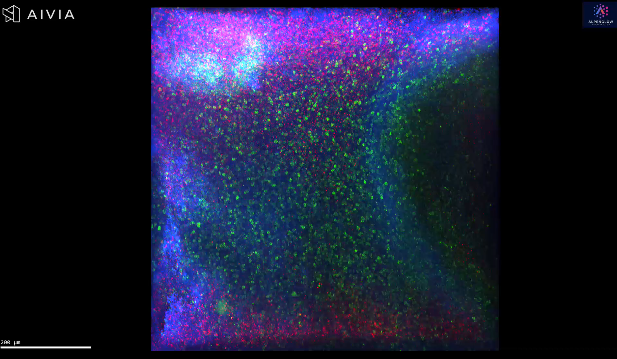 3D Visualization of TLS in Colorectal Tumor Tissue