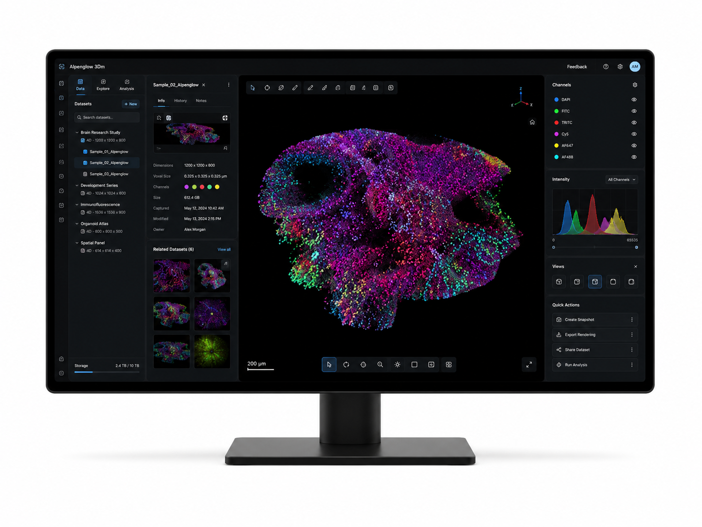 3Dm data management interface for large 3D tissue datasets