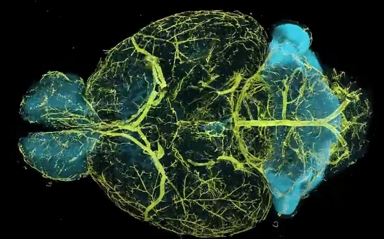 High-resolution 3D imaging of an entire mouse brain