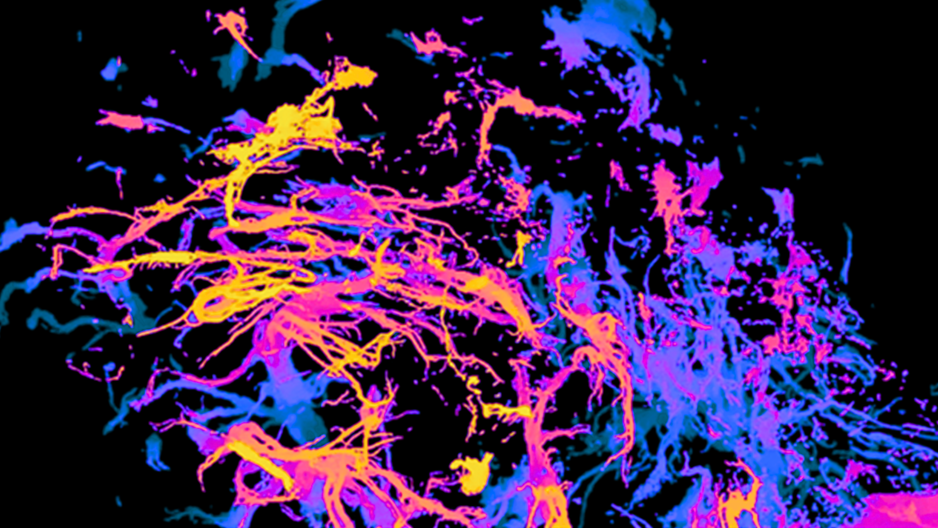 3D Imaging of blood vessels in human placenta