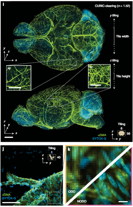 Targeted NODO imaging of a sub-region centered on a branching arteriole resolves individual smooth muscle cells and sub-nuclear features that are not resolved by ODO imaging.
