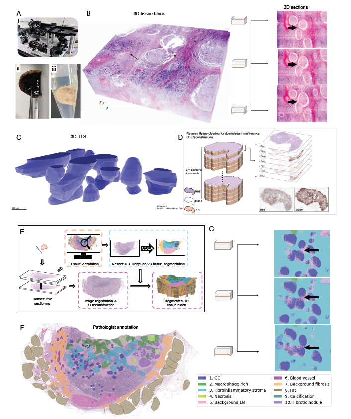 New article: 3D OTLS reveals interconnected immune structures in melanoma
