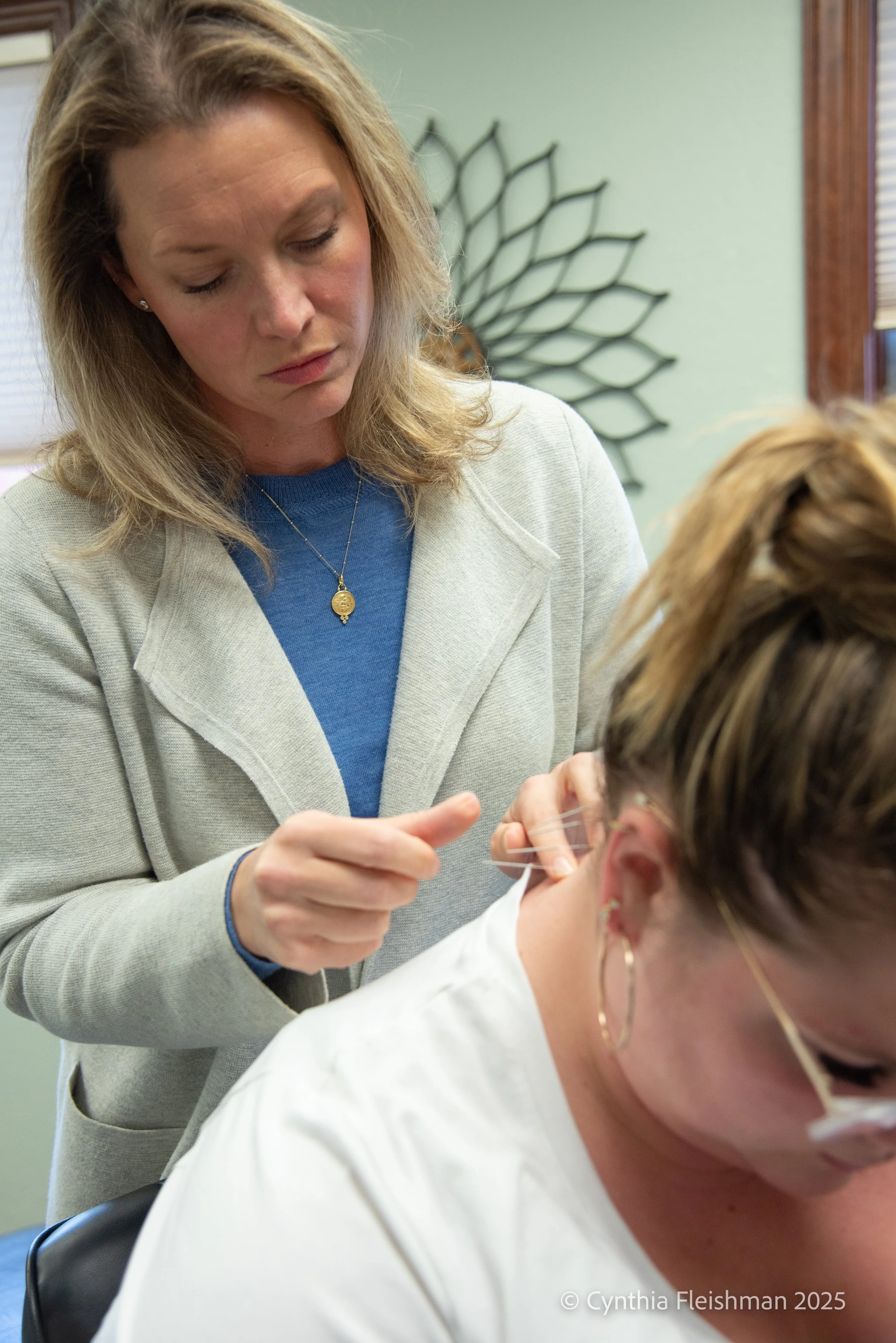 Dry Needling