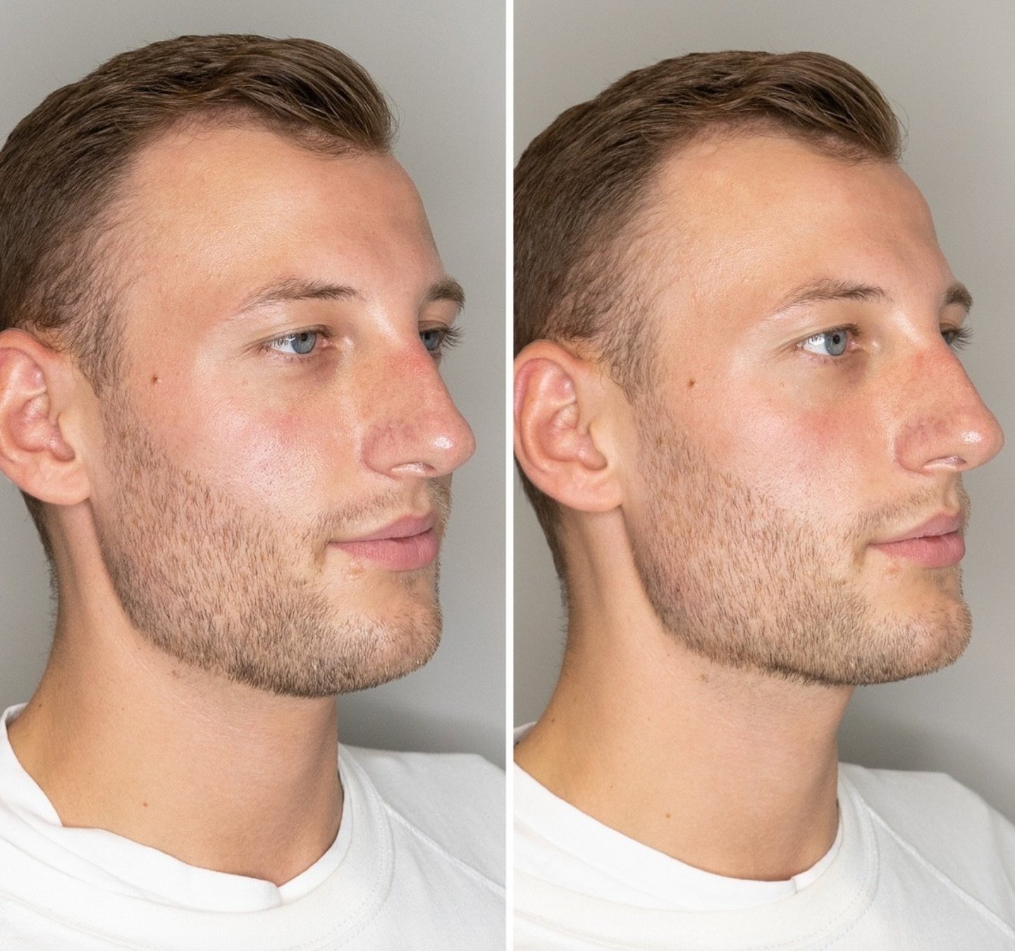 Cheeks, Jawline contour and chin projection, all have a major impact on your overall facial balance. If you&rsquo;ve been thinking about improving your best features, come see us for a free consultation.