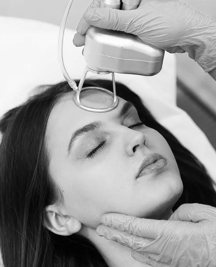 Microneedling + CO2 Laser Combination