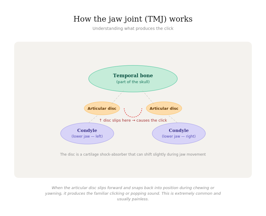 Diagram showing how the TMJ jaw joint works and what causes jaw clicking