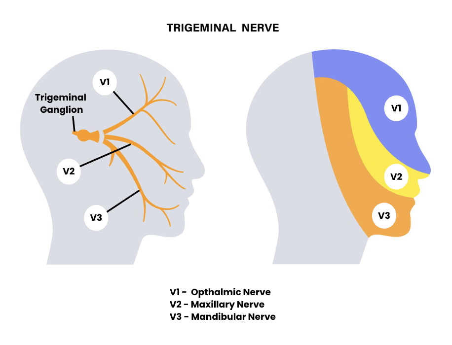 Diagram of the trigeminal nerve showing three branches connecting jaw, cheek and forehead to explain TMJ headaches