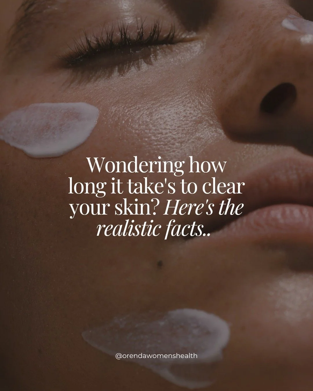 Skin is a doozy, we know it. 

We&rsquo;ll tell you know, tackling a skin condition through a holistic approach isn&rsquo;t for the faint hearted. 

It takes a whole lot of time, consistency and patience topped with a little sprinkle of tears (someti