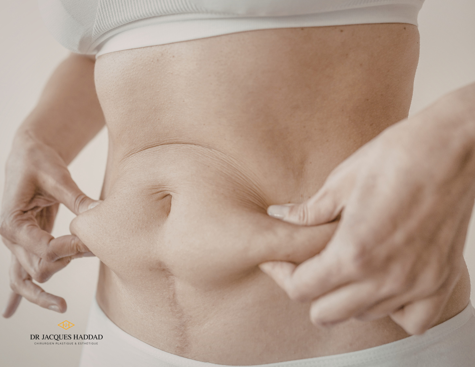 Liposuction or tummy tuck