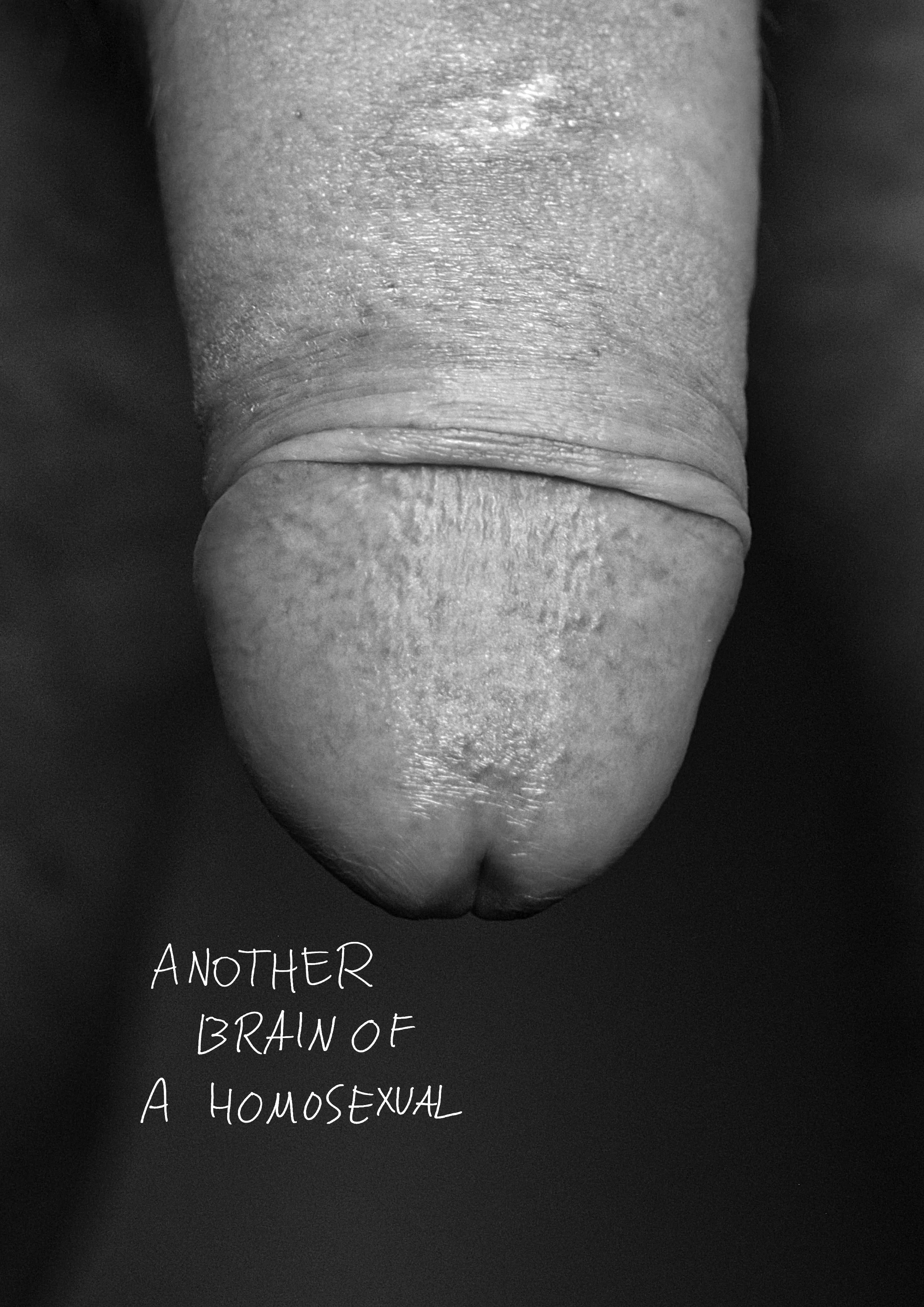 Close-up black and white photo of a finger, with handwritten text 'Another brain of a homosexual'.