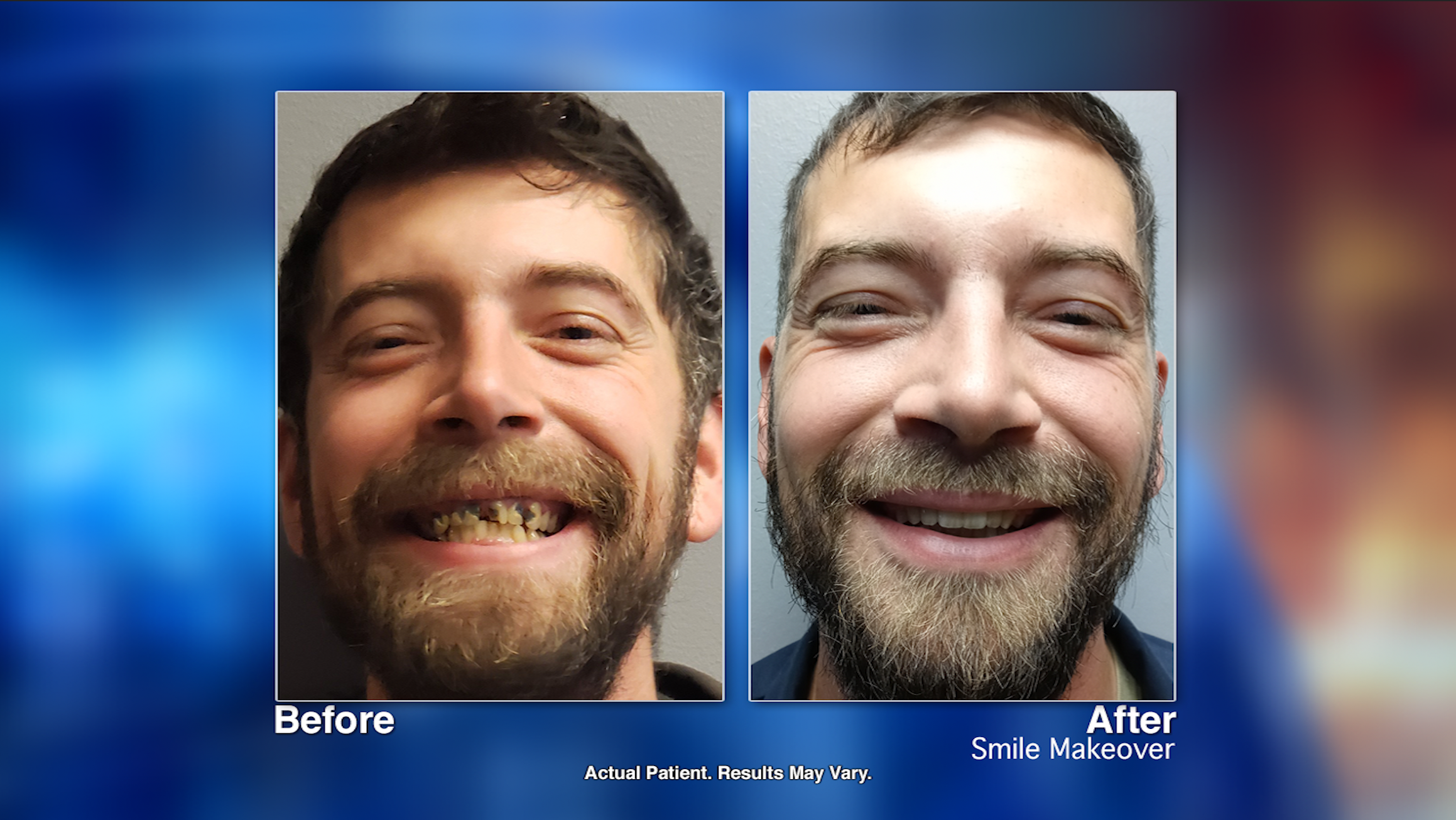 Revolution Dental Implant Center Your Smile’s Transformation