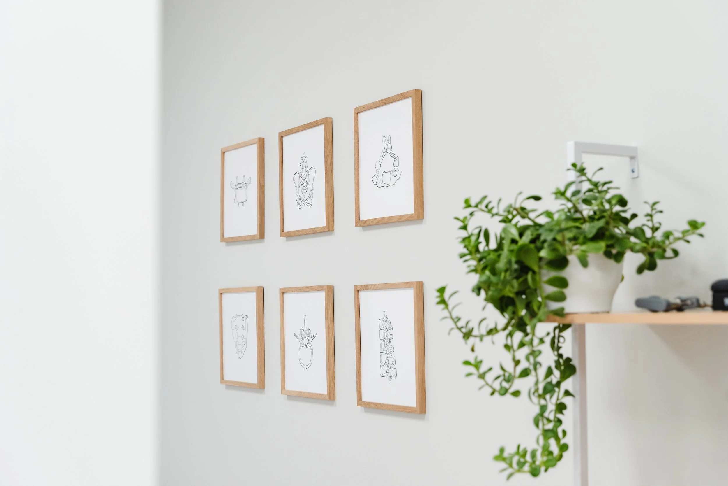 Low Back Pain vs. Sciatica: What’s the Difference?