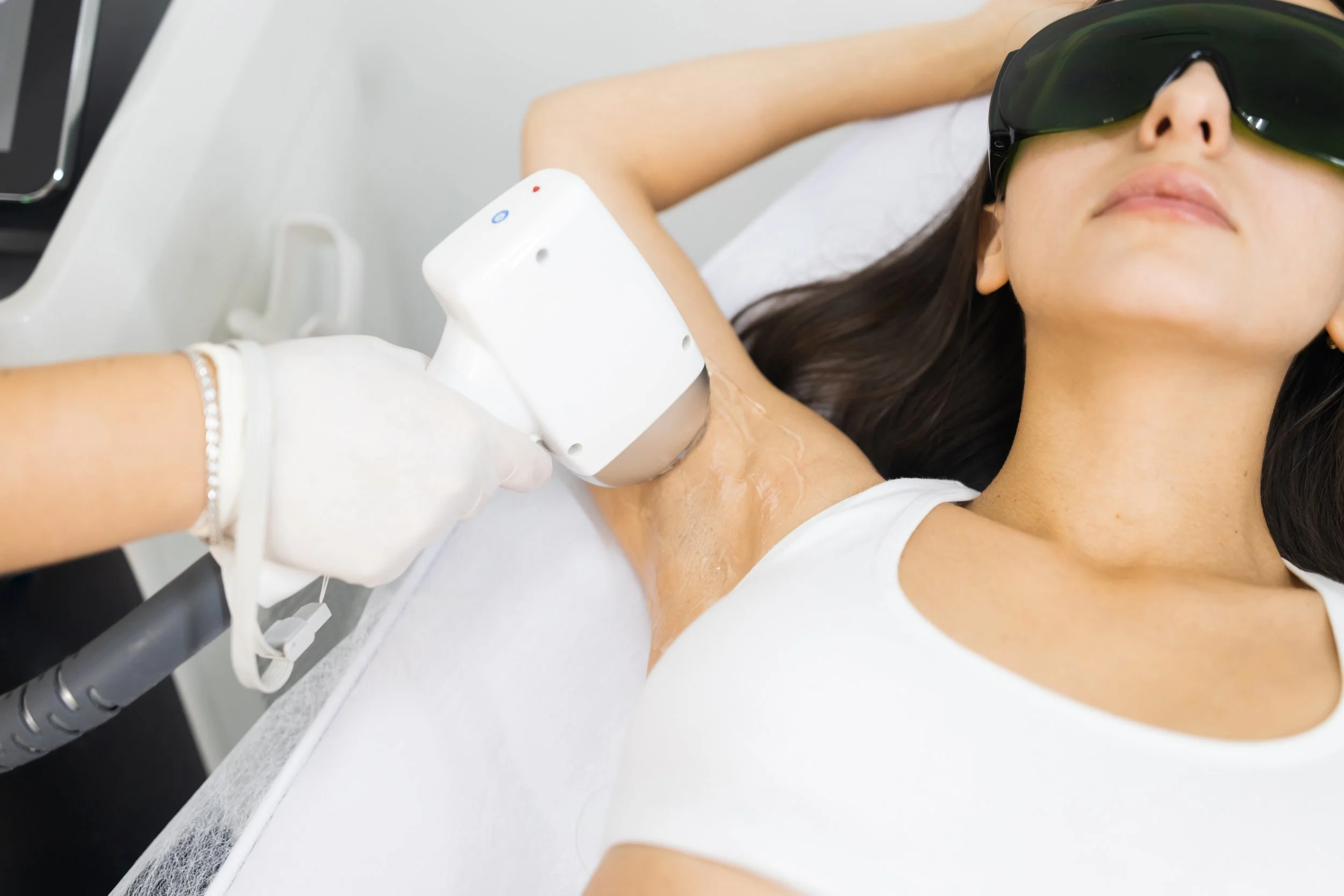 Woman receiving laser hair removal treatment on her armpit while laying on a medical bed, wearing protective glasses.