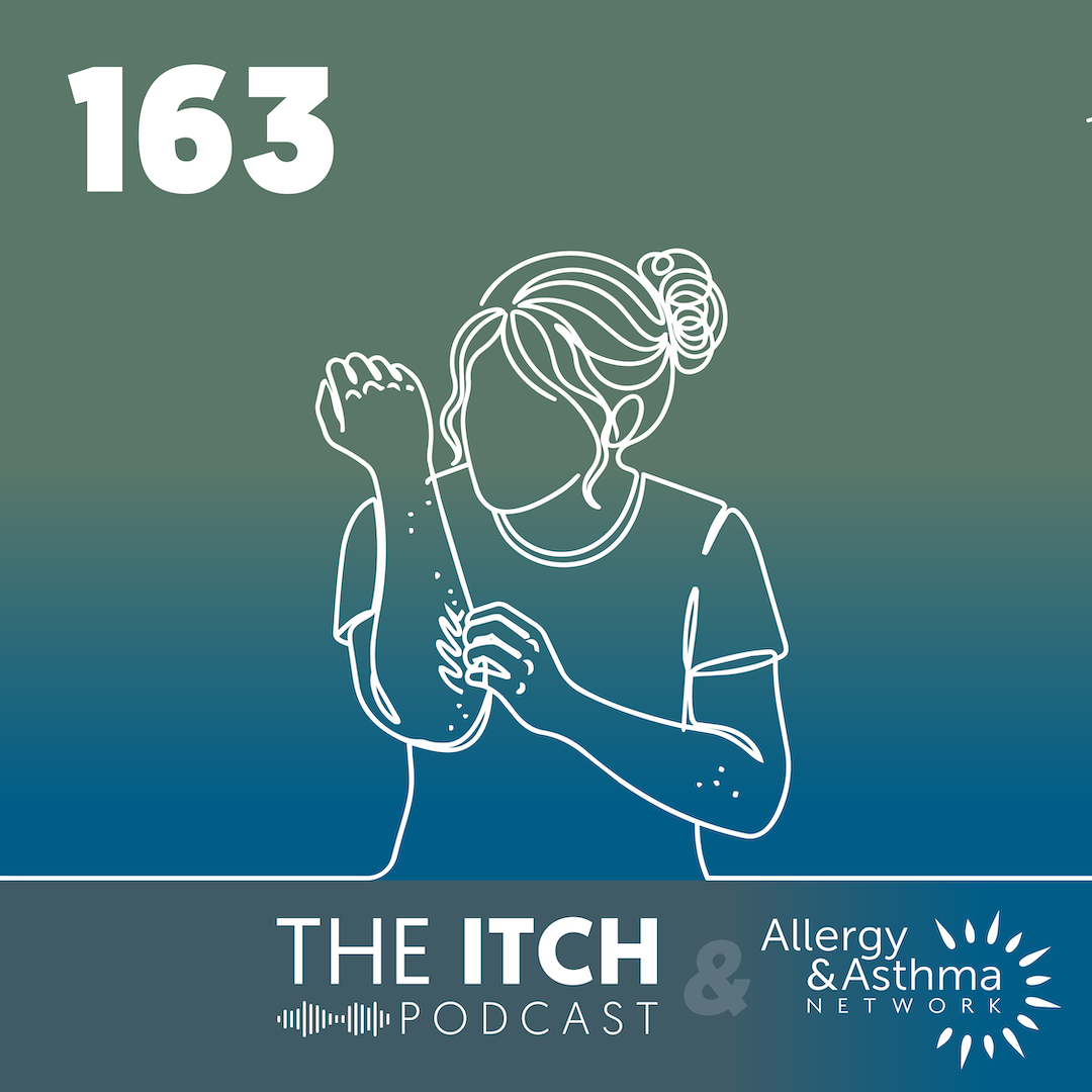 Ep. 163: Understanding Chronic Spontaneous Urticaria: Hives Demystified (Originally Ep. 75)