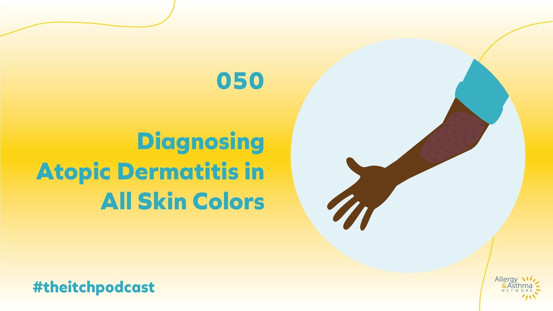 Ep+50+diagnosis+eczema+in+skin+of+color-12.jpg