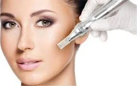microneedling.jfif