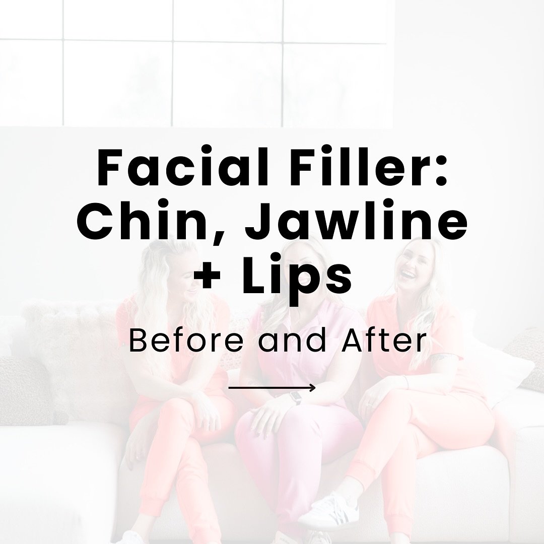 Swipe ➡️ to see this stunning transformation! At A Younger You Aesthetics, we use strategic filler placement to refine your chin, define your jawline, and perfect your pout&mdash;all with natural-looking results.

Ready to love your profile? Book you