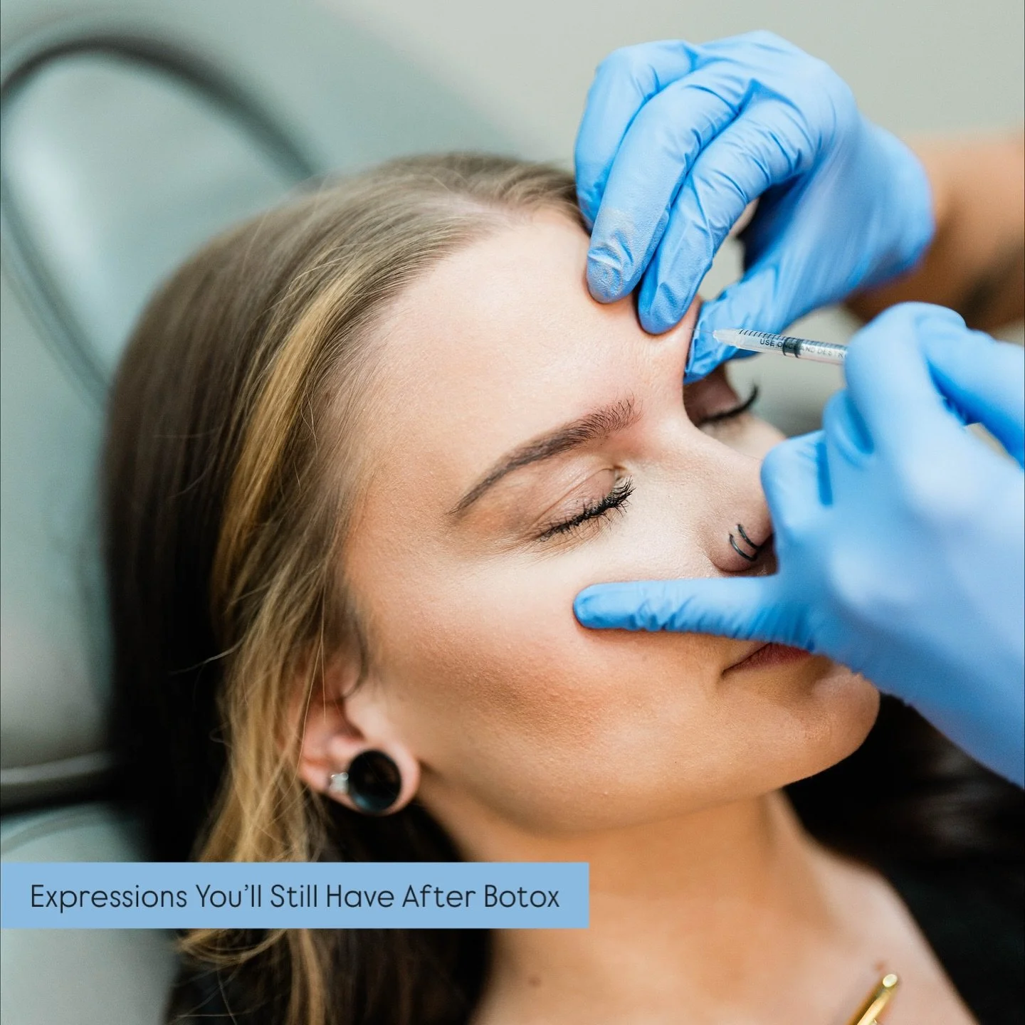 The goal isn&rsquo;t frozen &mdash; it&rsquo;s refreshed. 💉✨

Botox isn&rsquo;t about erasing every line &mdash; it&rsquo;s about softening movement, enhancing your natural expressions, and helping you look as rested as you feel.

Whether you&rsquo;