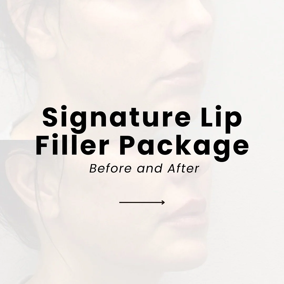 Small enhancements, big impact. 💋

Our Signature Lip Package combines lip and chin filler to create balance and harmony across your profile&mdash;subtly defining the lips while adding structure and support to the lower face.

The result? Natural-loo