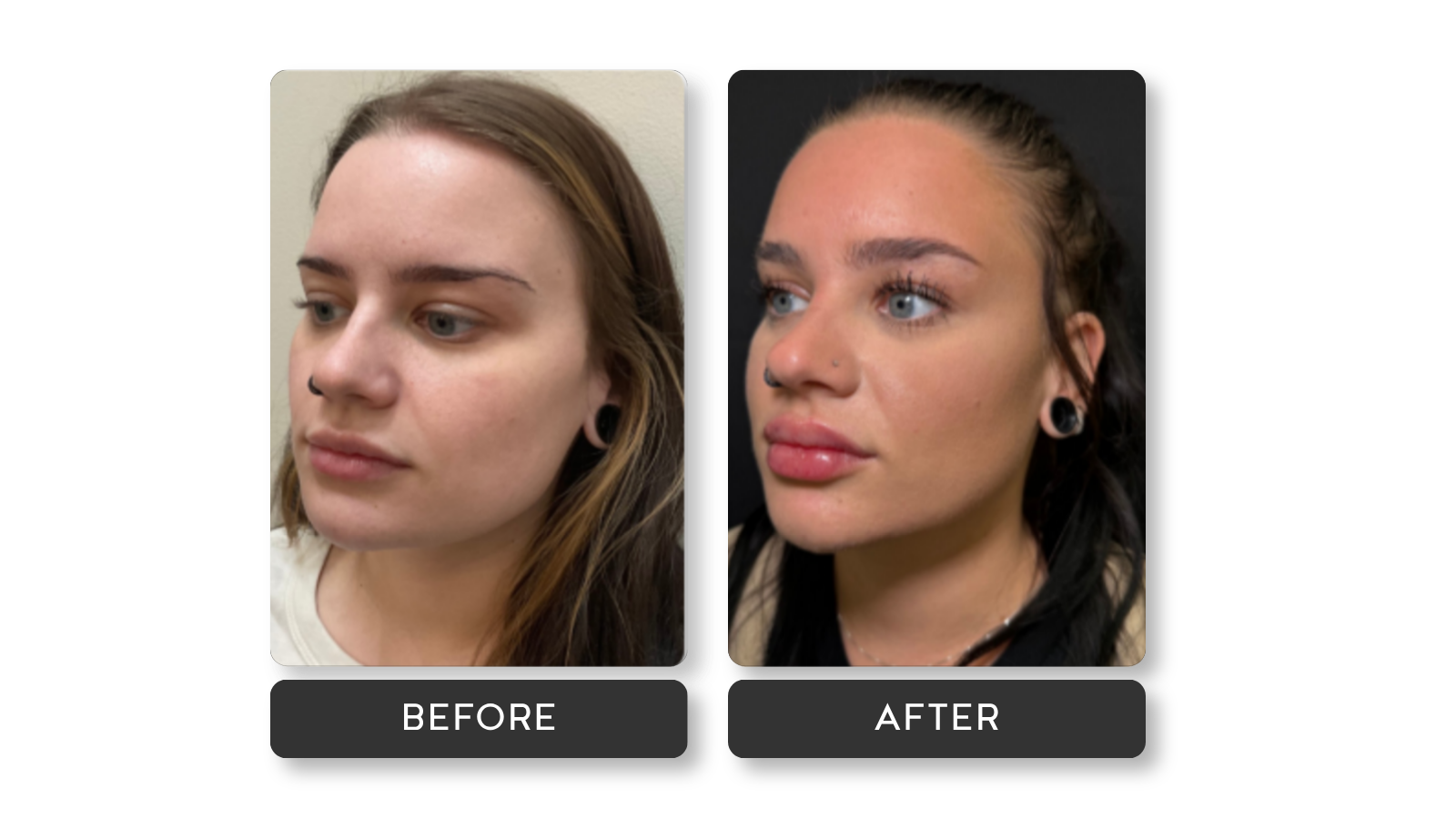 Signature lip results from A Younger You Aesthetics MedSpa