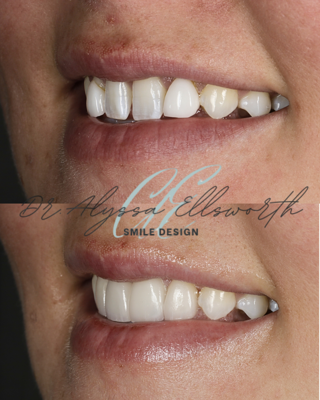 Copy of Copy of Before and after template  (1080 x 1350 px) (3).png