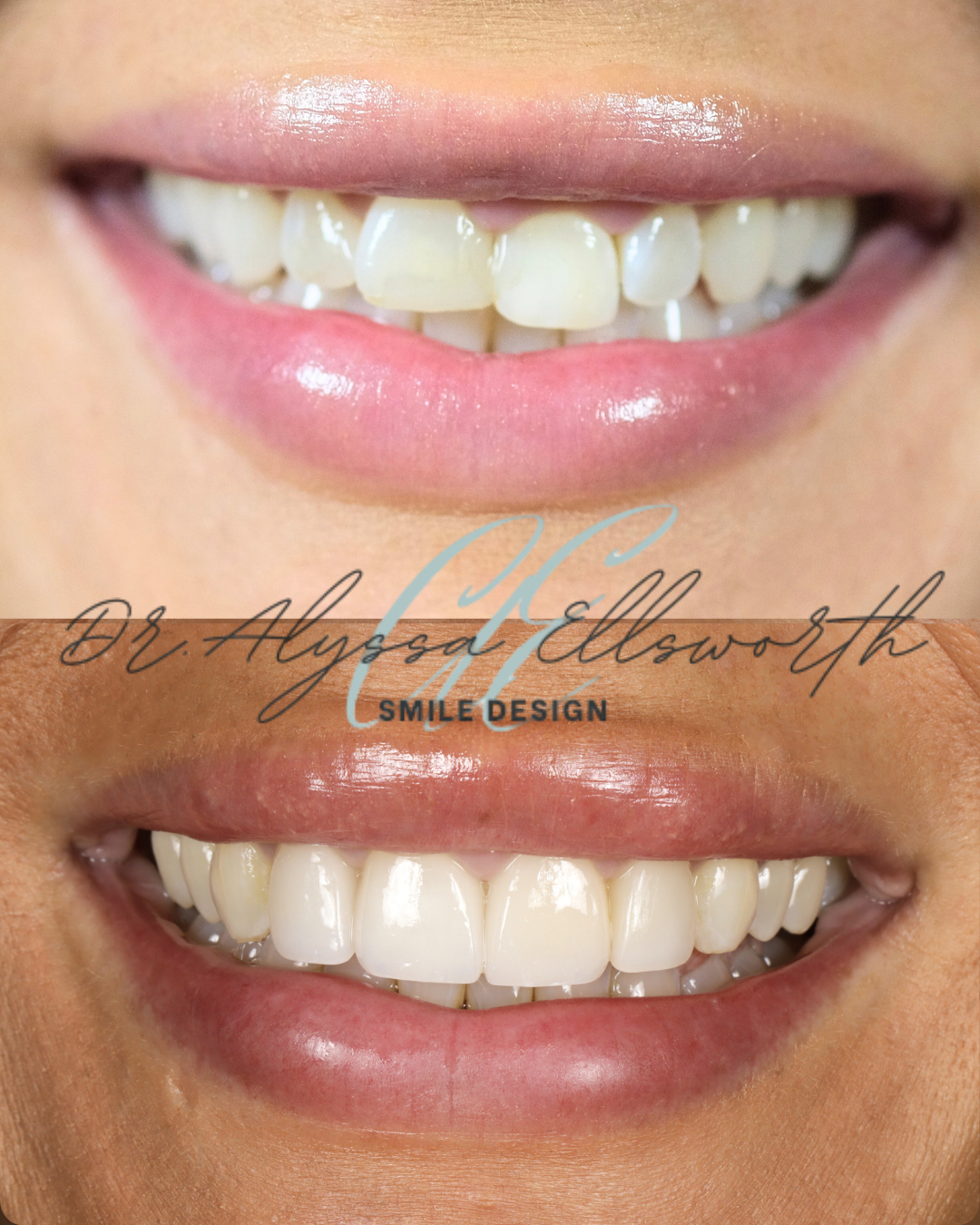 Copy of Copy of Before and after template  (1080 x 1350 px) 2.png