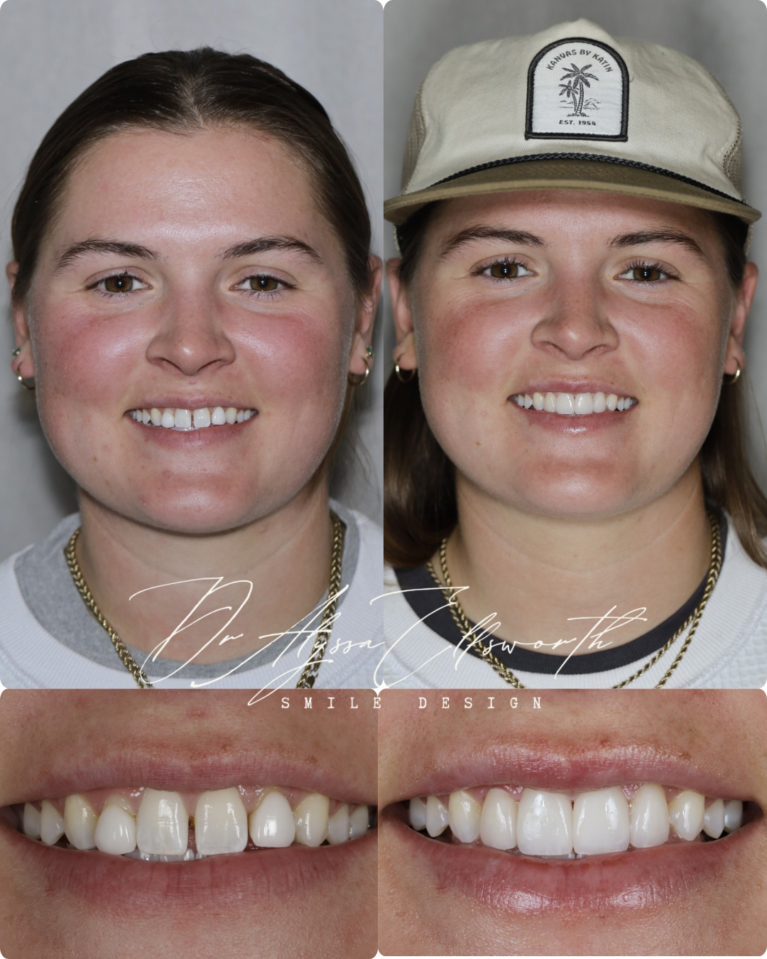 Portrait before and after 2.png