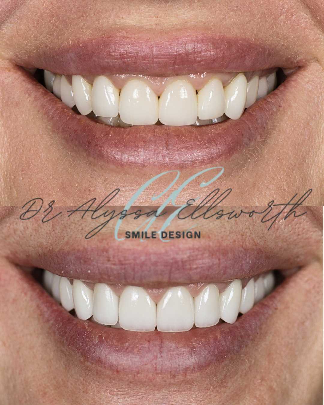 Copy of Copy of Before and after template  (1080 x 1350 px) 4.png