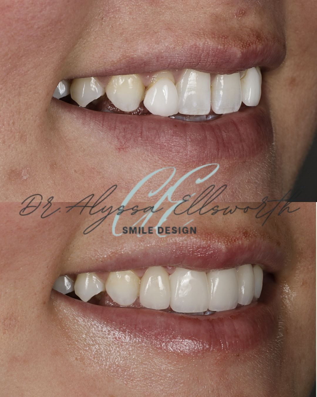 Copy of Copy of Before and after template  (1080 x 1350 px) (2).png