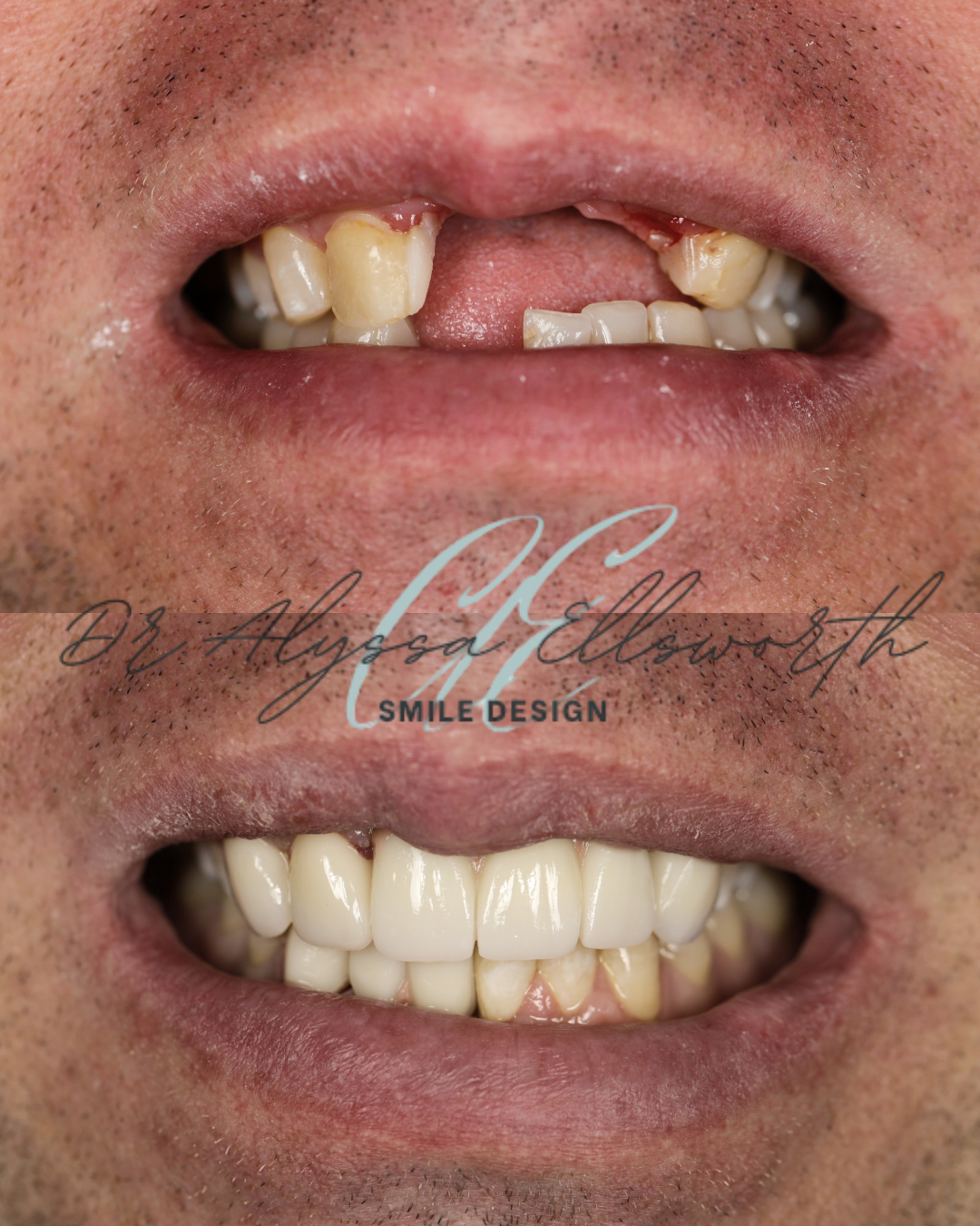 Copy of Copy of Before and after template  (1080 x 1350 px).png