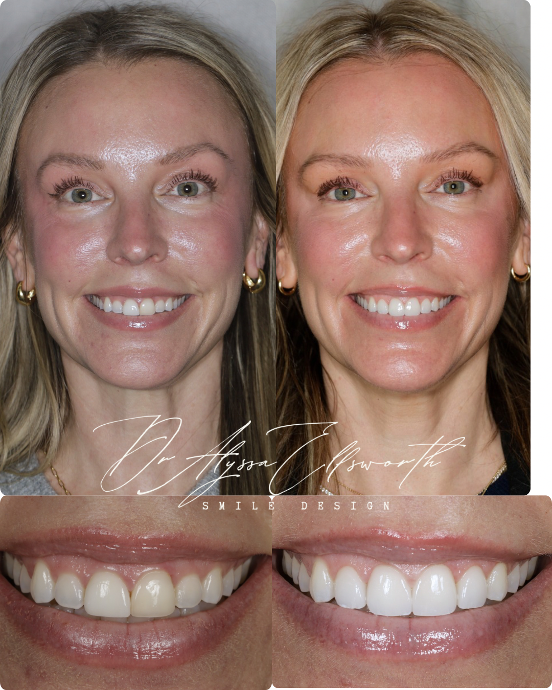 Portrait before and after 3.png