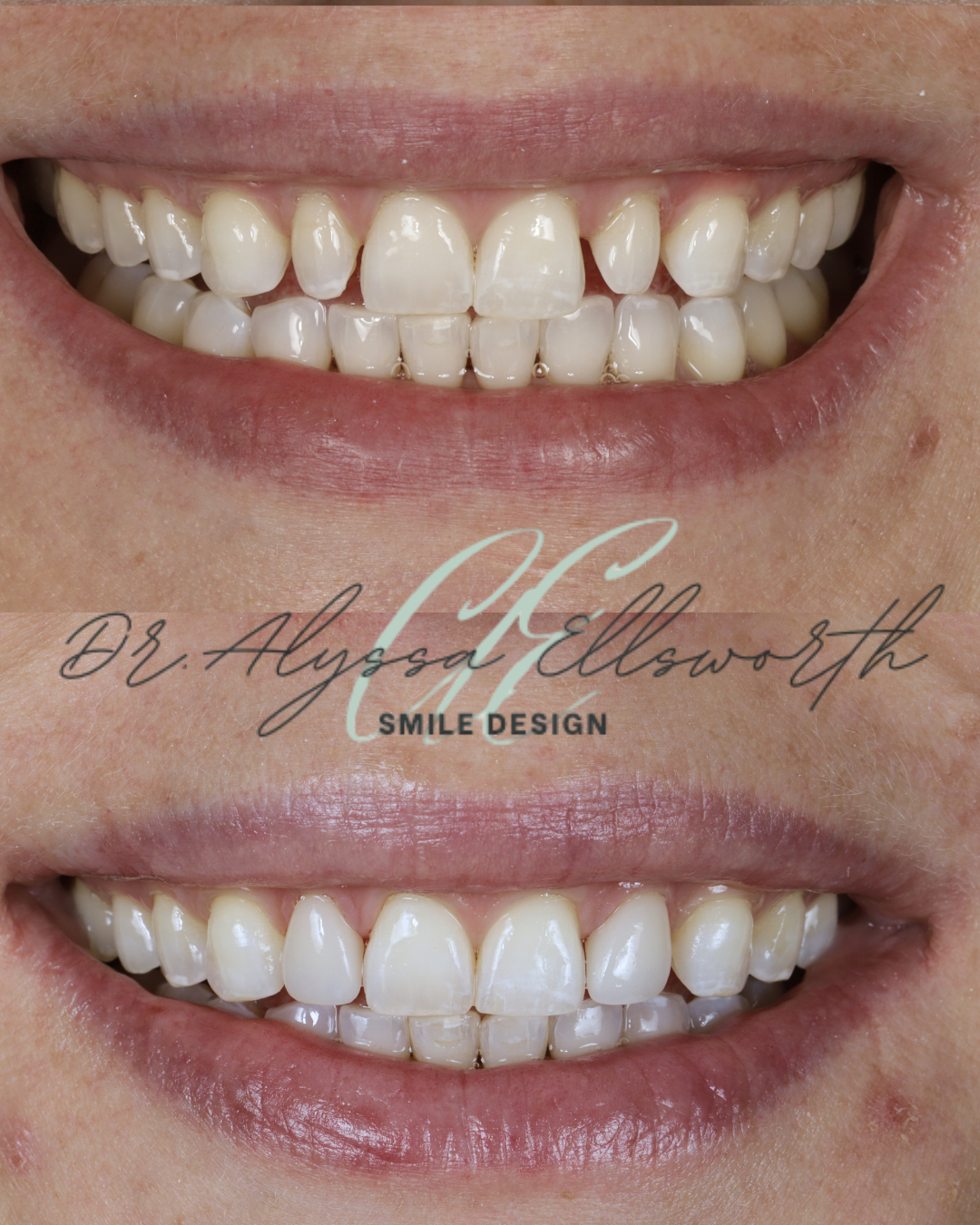 Copy of Before and after template  (1080 x 1350 px).png 2.png