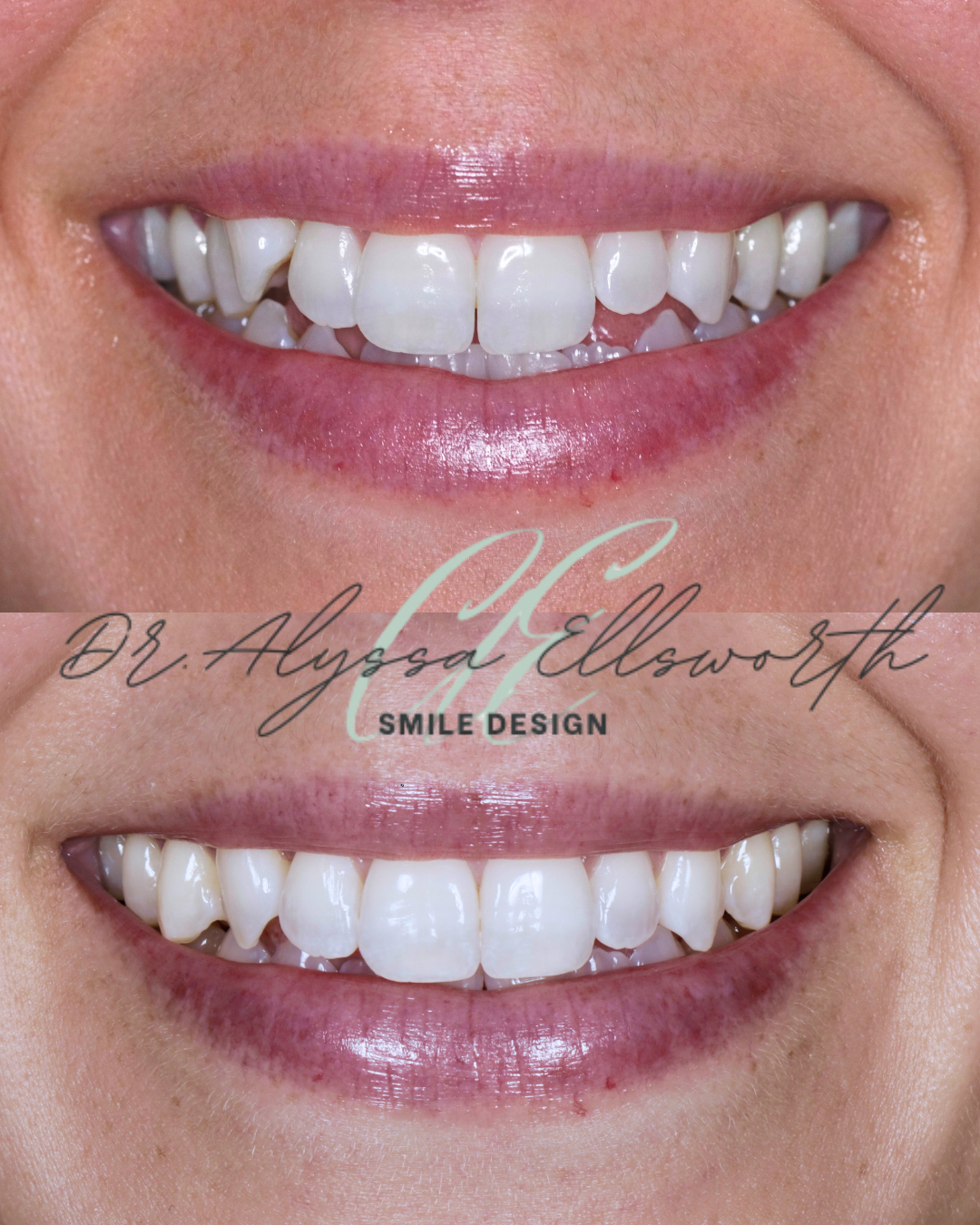 Copy of Before and after template  (1080 x 1350 px).png.png