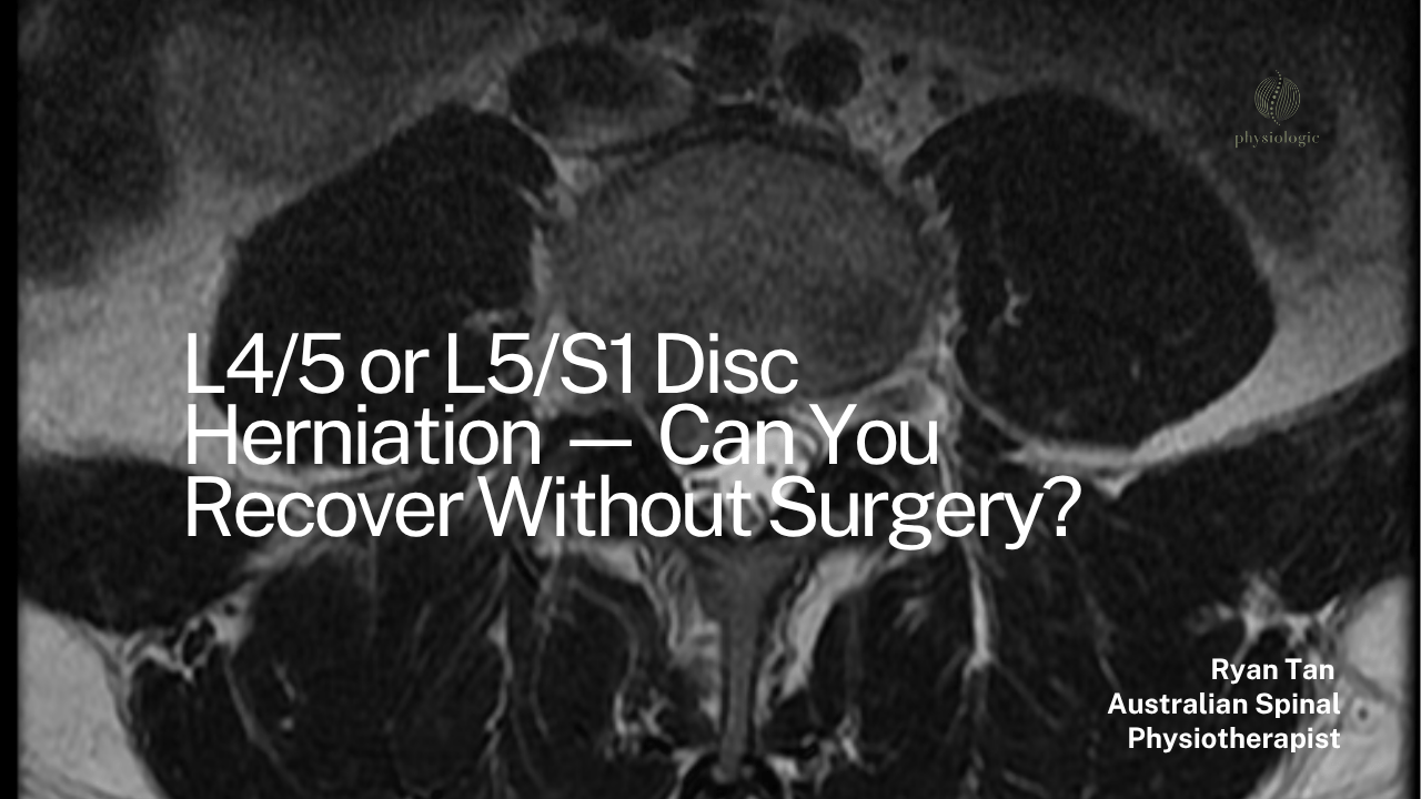 L4/5 or L5/S1 Disc Herniation — Can You Recover Without Surgery?