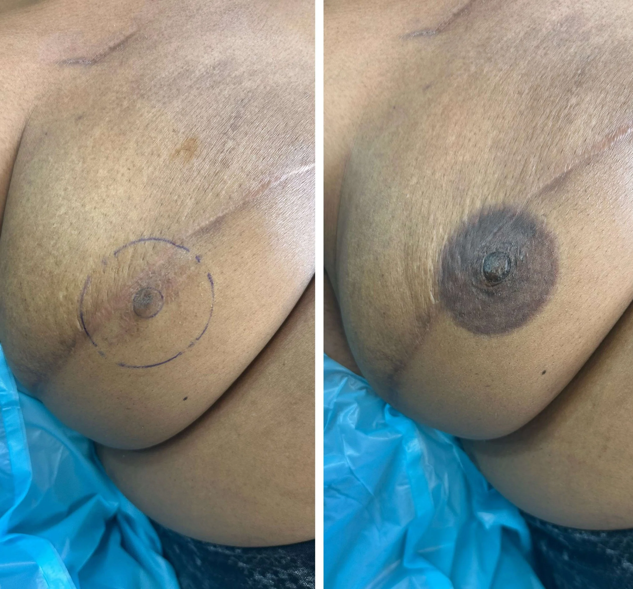 areolasmallerfile.JPG