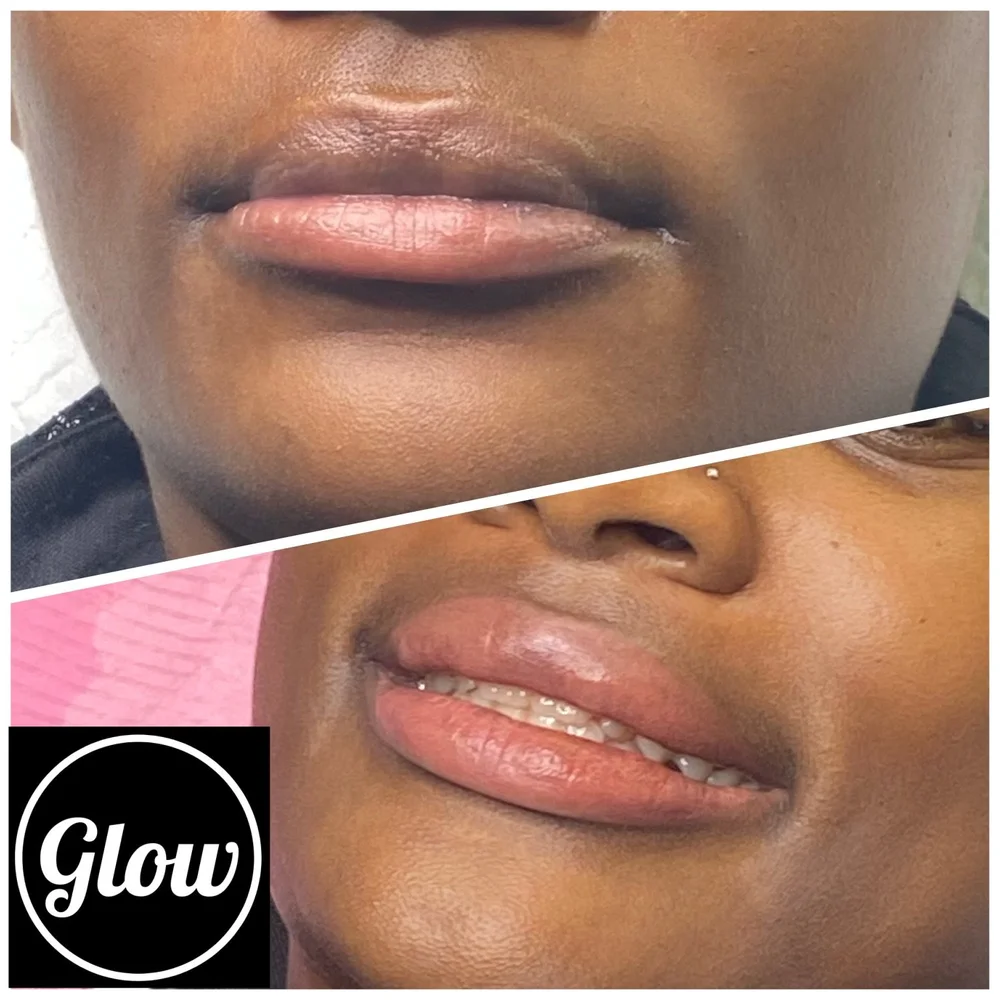portfolio of work before after cosmetic tattoo — Glow Cosmetic Tattoo Studio portfolio of work before after cosmetic tattoo — Glow Cosmetic Tattoo Studio