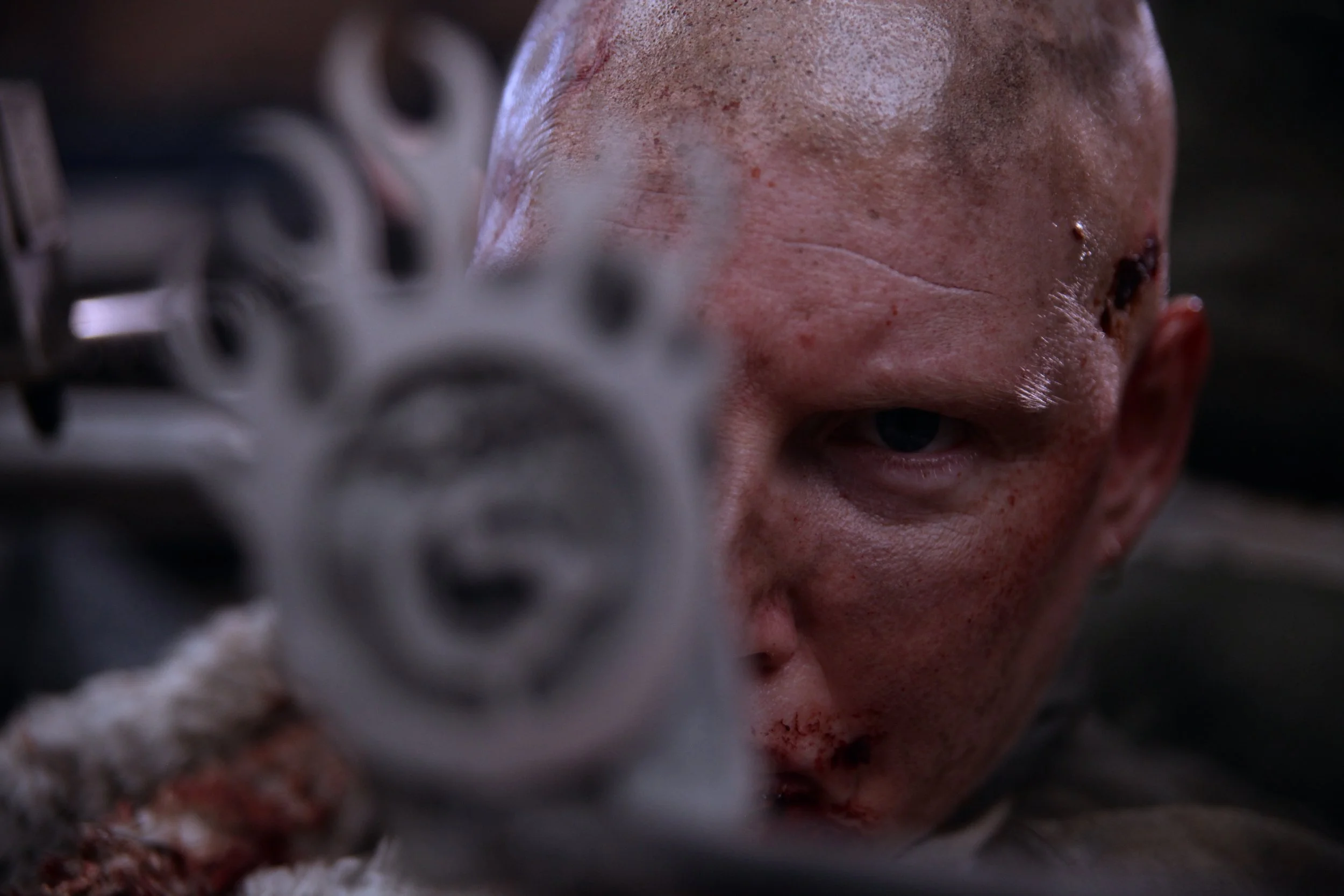 Same image with the microphone blurred out, the focus is on my bloodied scowling face. Grey shirt, browned with stains.