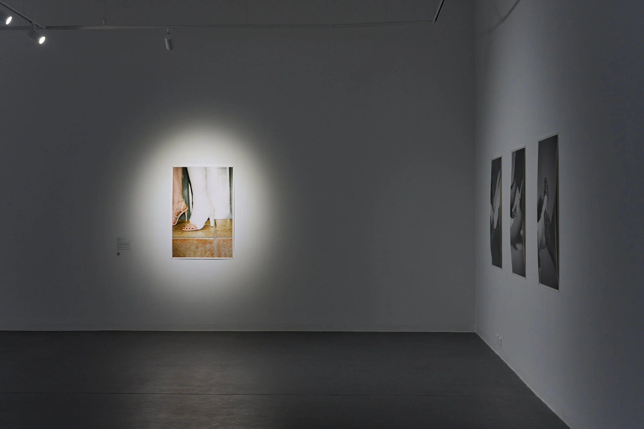 Installation view of the photos hanging in the gallery. Colour photo of the cast leg hangs in the middle of the wall with light illuminating it. The triptych of black and white photos hangs on a wall to the right.
