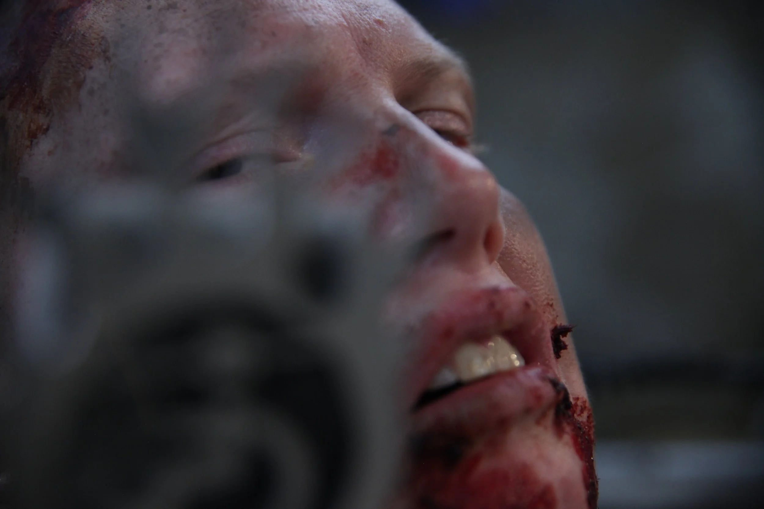 A close up of my face, with both eyes looking directly at the viewer. My facial expression conveys anger and exhaustion. A metal microphone is blurred, obstructing my face.