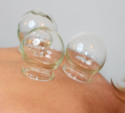 Cupping for Relief from Pain, Colds + Flu