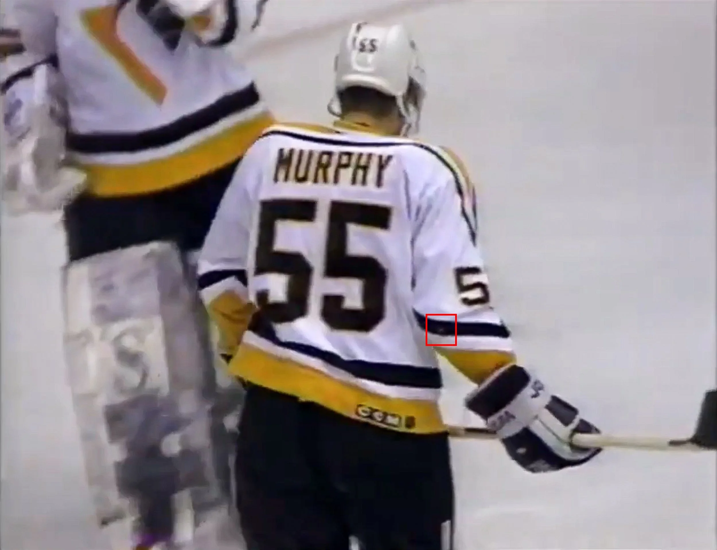The aforementioned right arm burn comes through in this still.