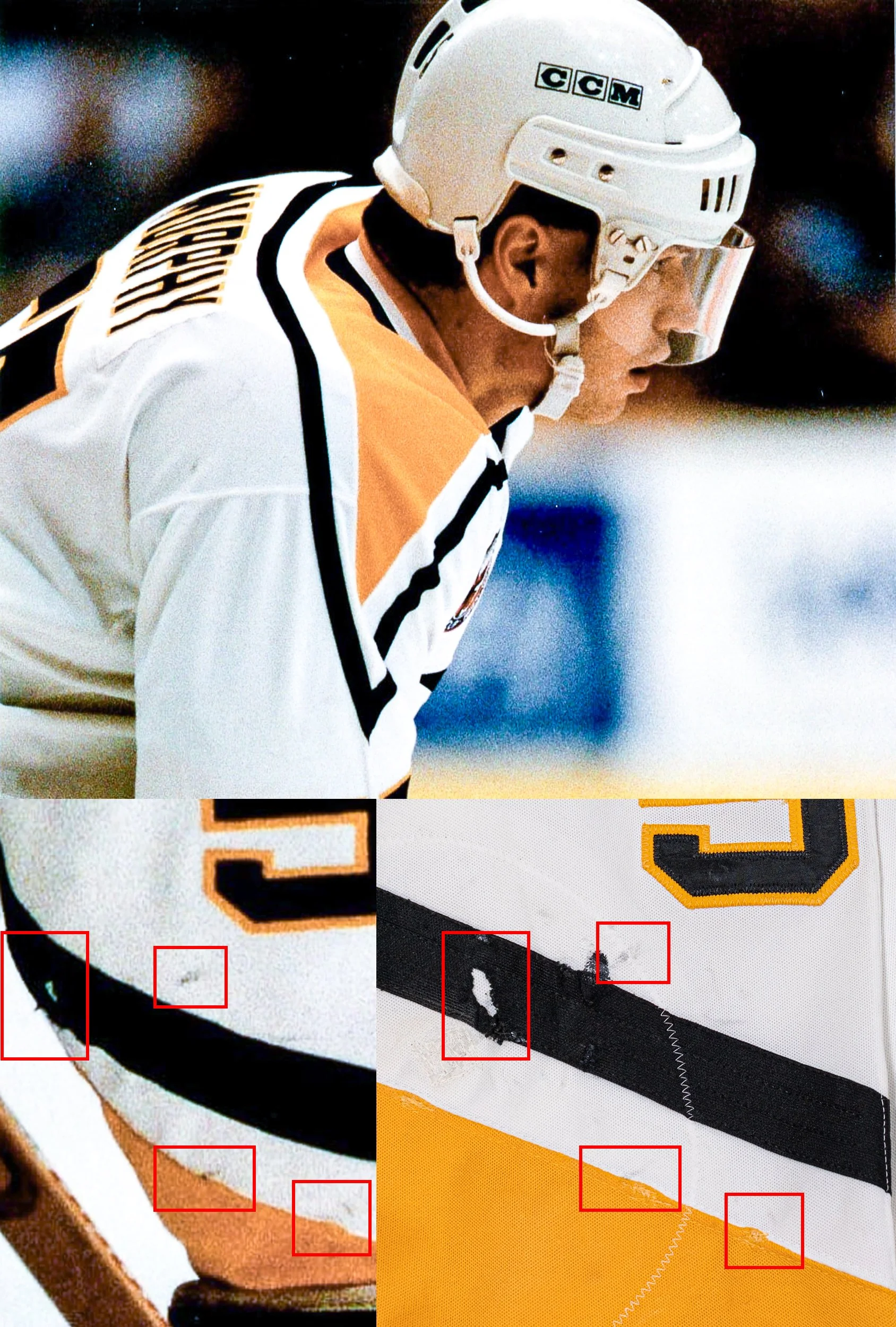 Several stick marks and a deep burn can be clearly seen here.