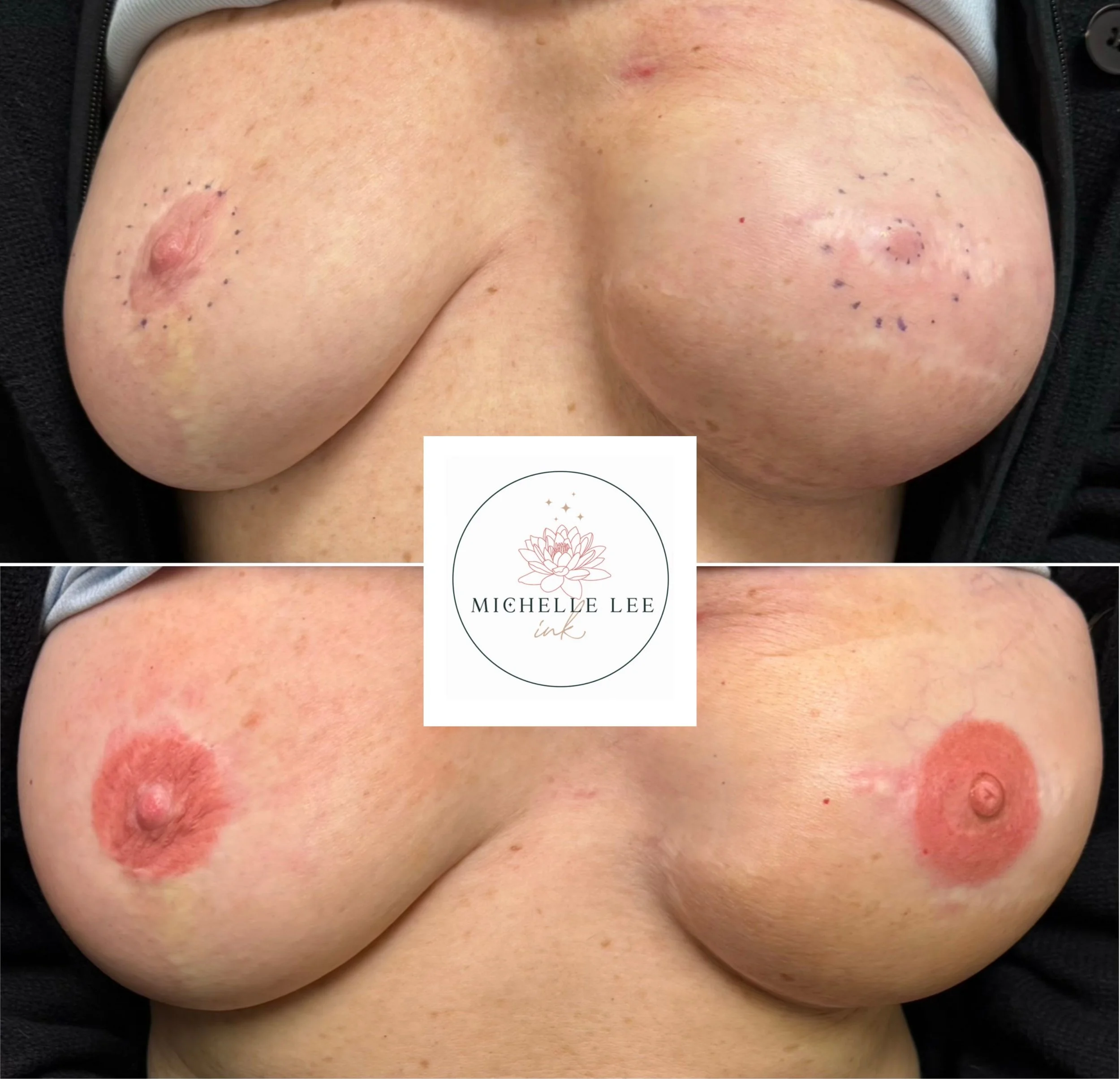 3D Areola & Nipple Restorative tattoo post mastectomy