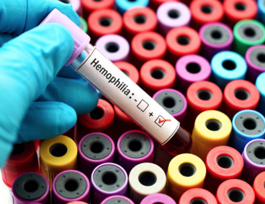 We Need More Studies of People With Mild Hemophilia